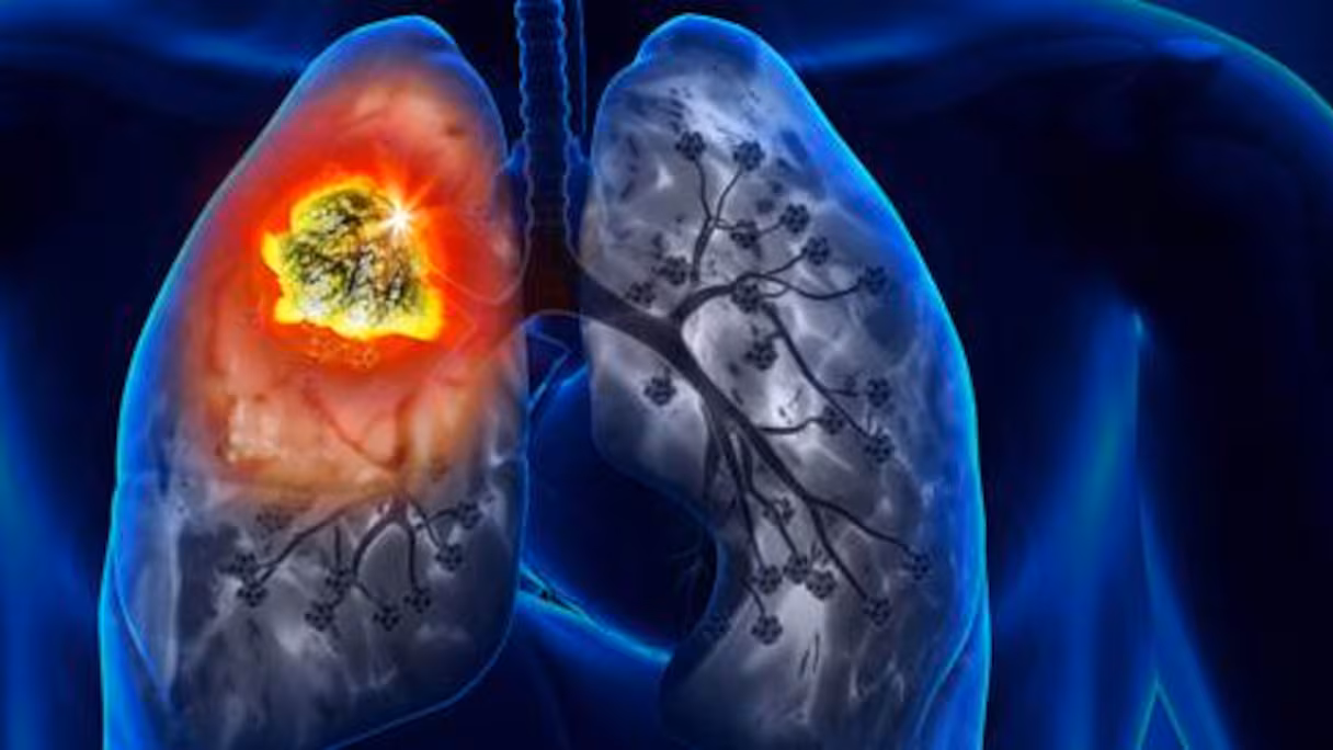 CAZNMZPIFZB2NGYME2V2H4K5BY