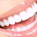 في عيادة لبنانية.. جَمّل أسنانه وهرب!