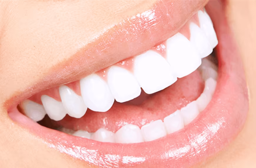 في عيادة لبنانية.. جَمّل أسنانه وهرب!